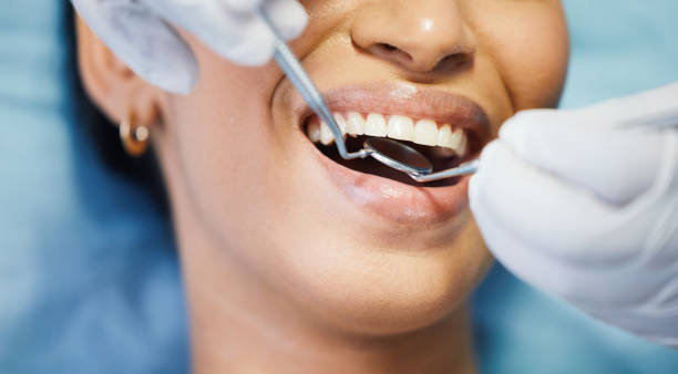 Best Emergency Root Canal Treatment in Wolf Creek, UT